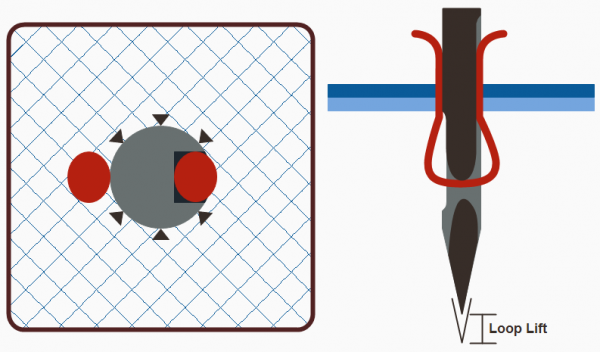 Small needle large thread combination